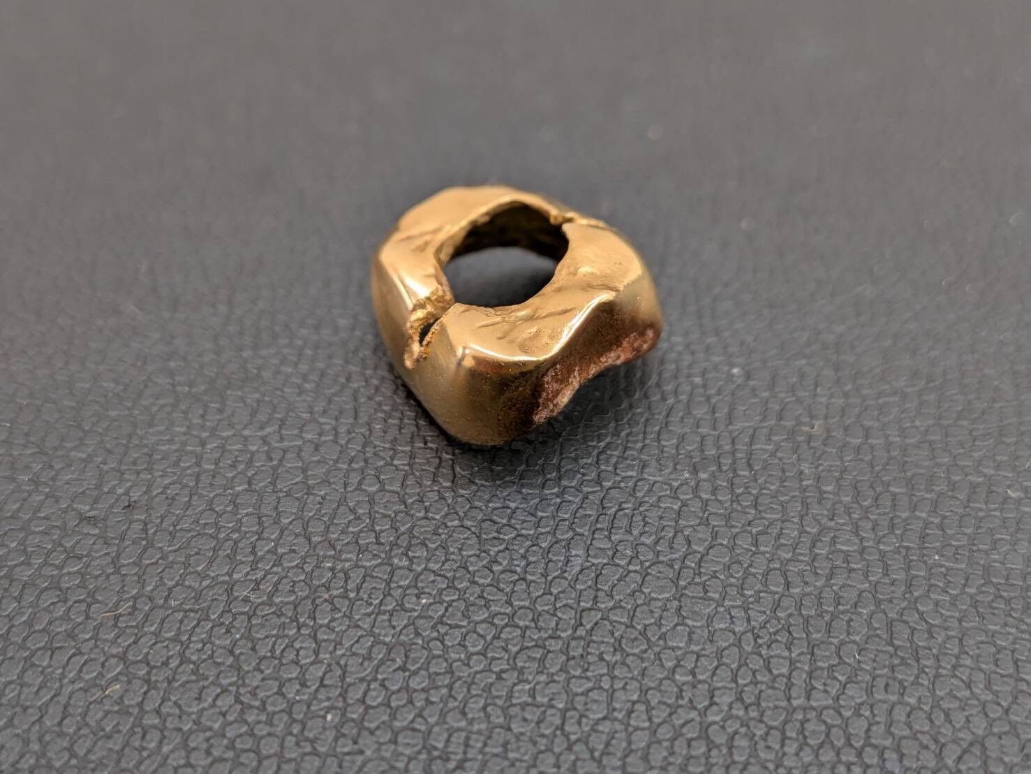 金歯